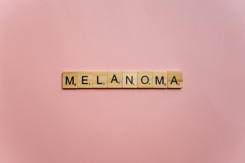 melanoma