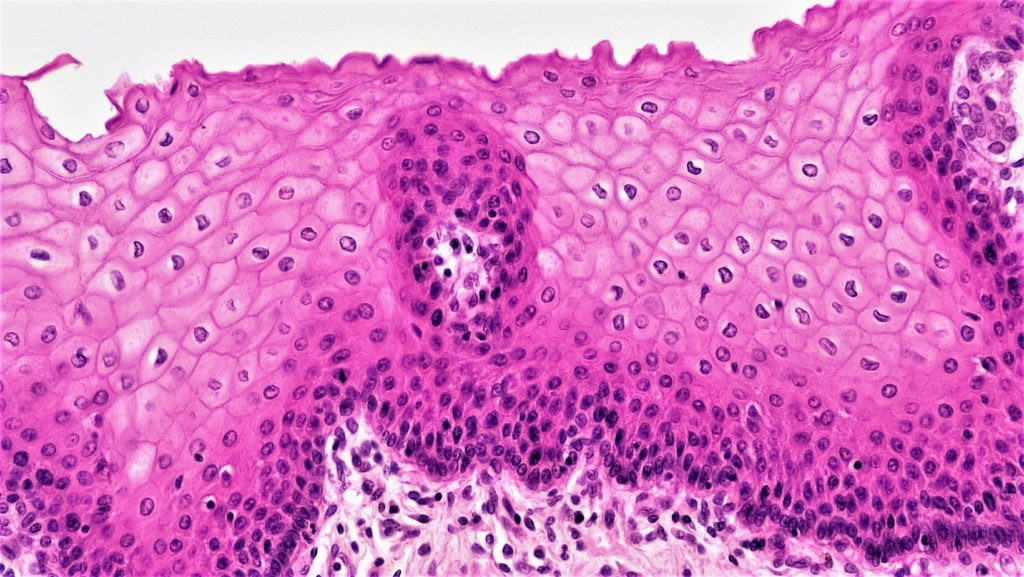 Stratified squamous epithelium
